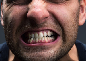 Bruxism Is A Silent Cause Of Damage To Your Teeth