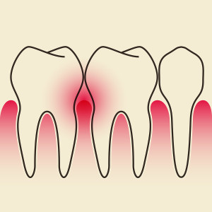 Questions And Answers About Periodontal Health