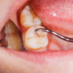 Managing Your Periodontal Disease