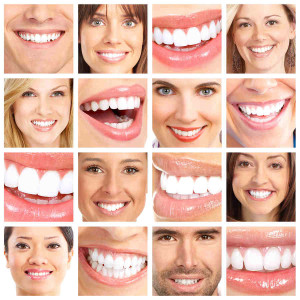 What Is a Cosmetic Dentistry smile makeover?