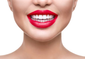 Are You A Candidate For Porcelain Veneers? 