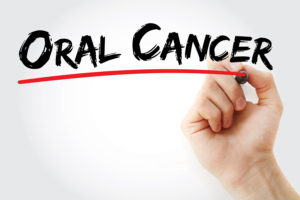 Oral Cancer Can Be Spotted By Dentists Too