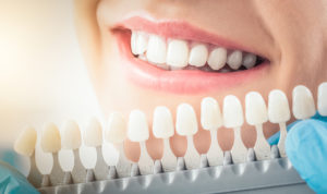 Consider Dental Implants When You Need A New Smile