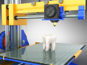 3D Printing Is Making Dentistry Cheaper And Faster