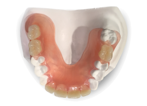 Clear Palate Dentures
