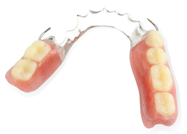 One Tooth-Multiple Teeth Partial Dentures