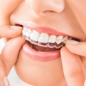 woman putting on invisalign tray