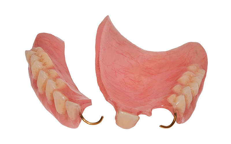 Dangers of bad dentures