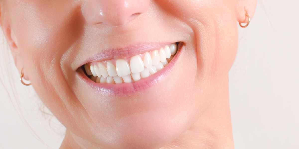 Your Guide to Cosmetic Dentistry Options Veneers versus Crowns