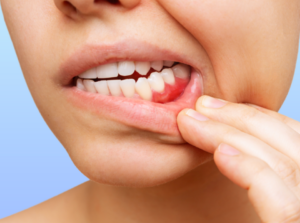 Dental care periodontal disease