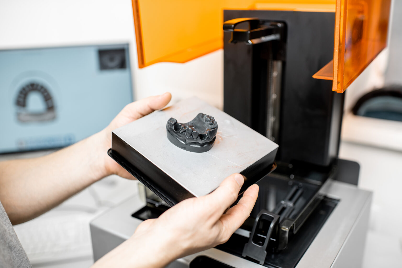 On-site 3D printer crafting custom dental model at Shine Dental