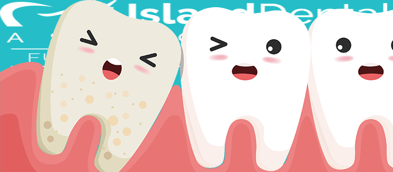 Wisdom teeth removal