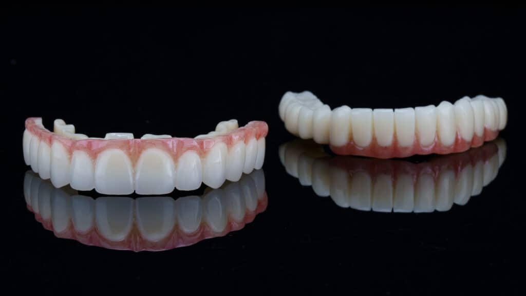 denture implants