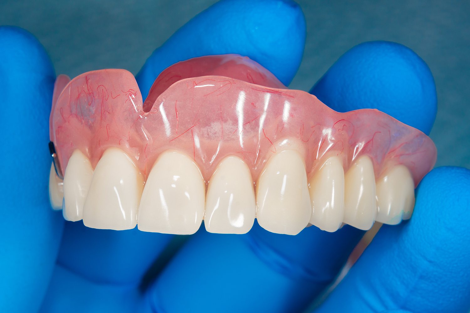 Denture questions answered