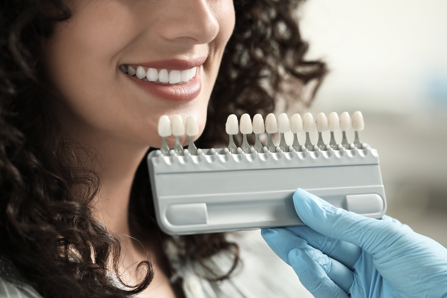 Beautiful porcelain veneers smile transformation at Island Dental