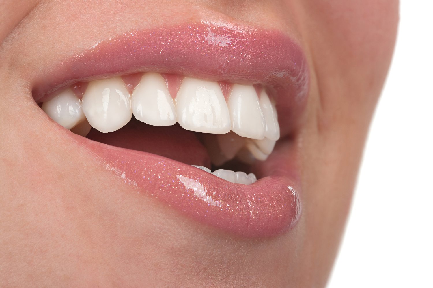 Full mouth reconstruction at Island Dental