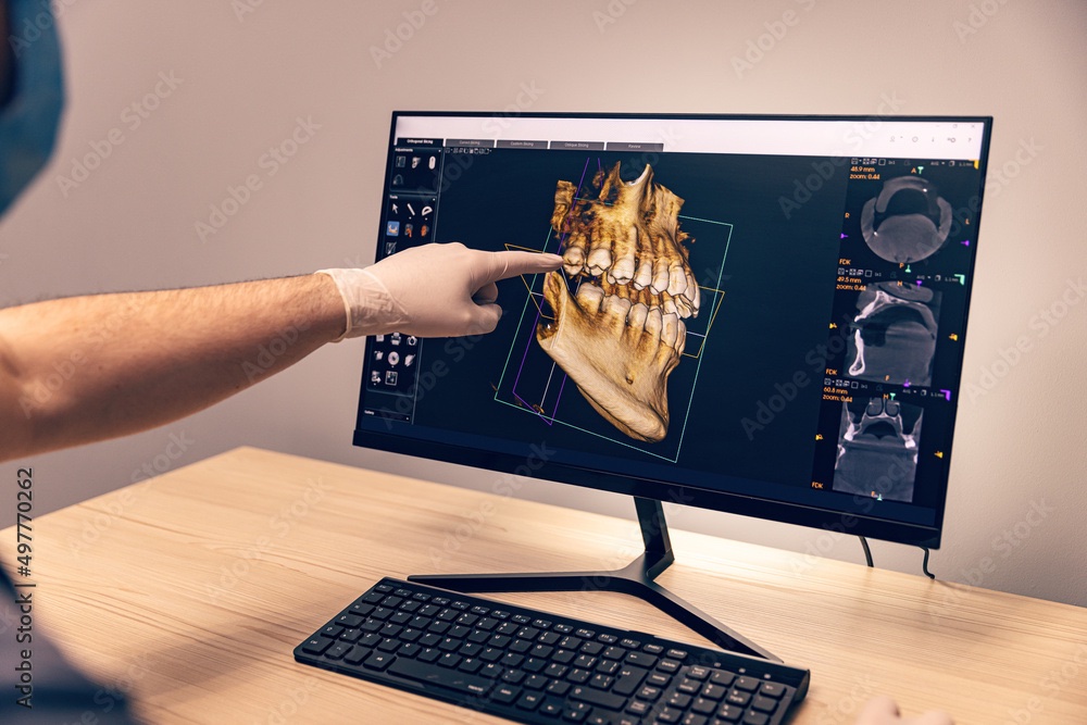 3D diagnostic scan for TMJ evaluation at Island Dental