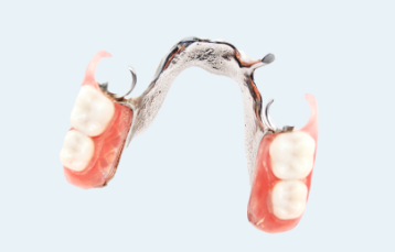 Custom partial denture made at Island Dental
