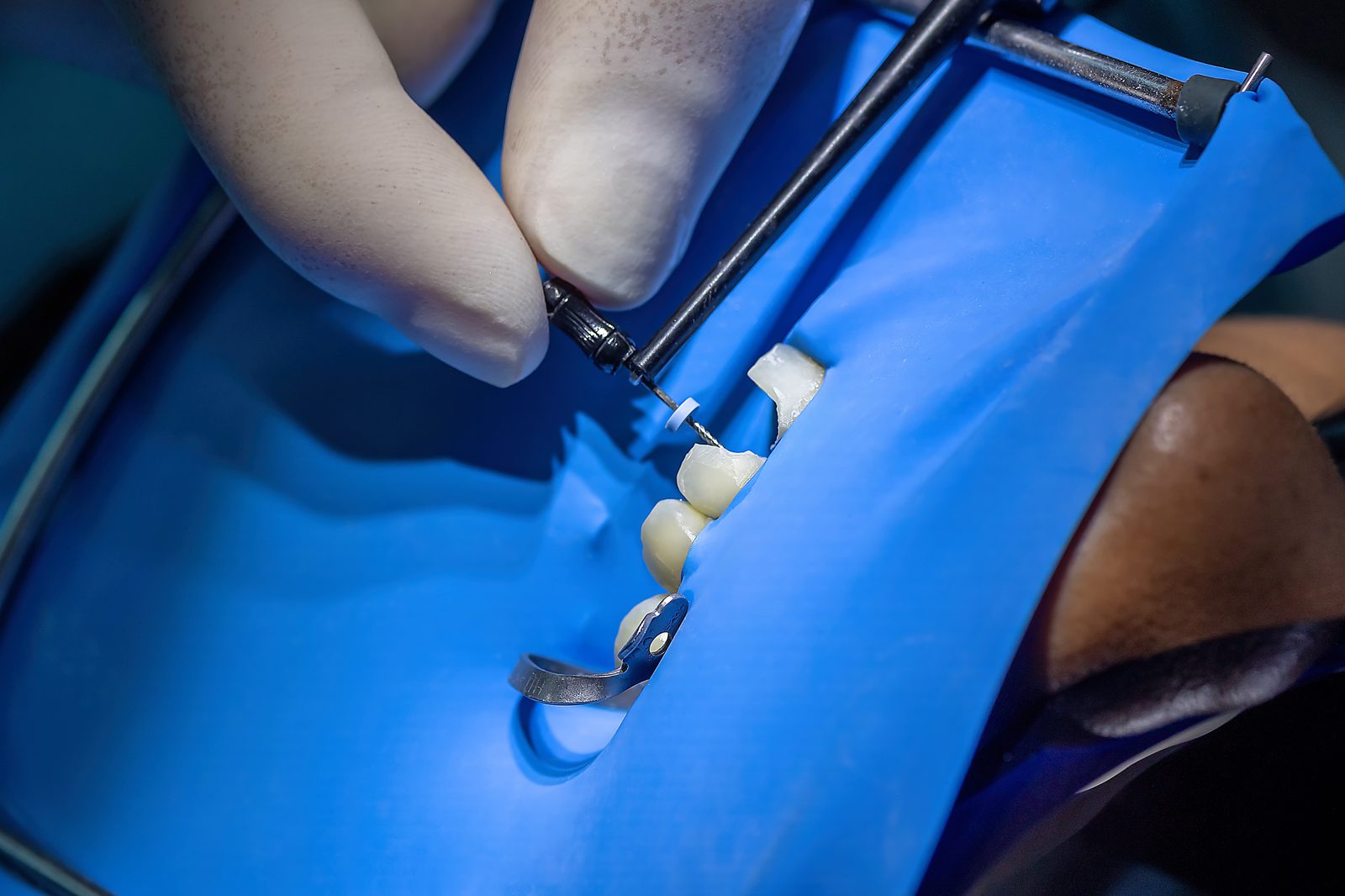 Reviewing insurance and payment options at Island Dental