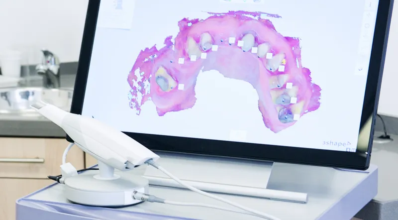 Digital scan and design workstation