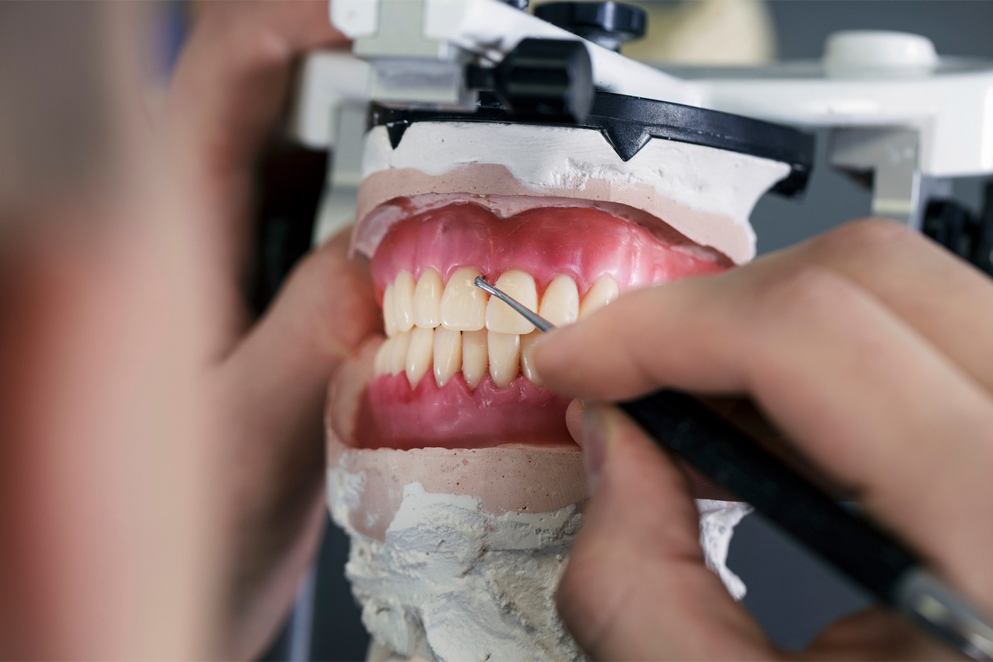 Denture being crafted in the Island Dental on-site laboratory