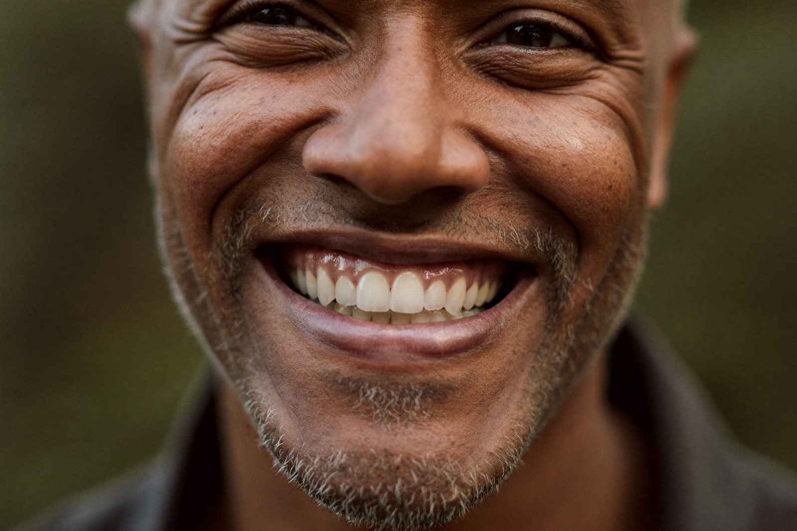 Patient smiling after gum recession treatment