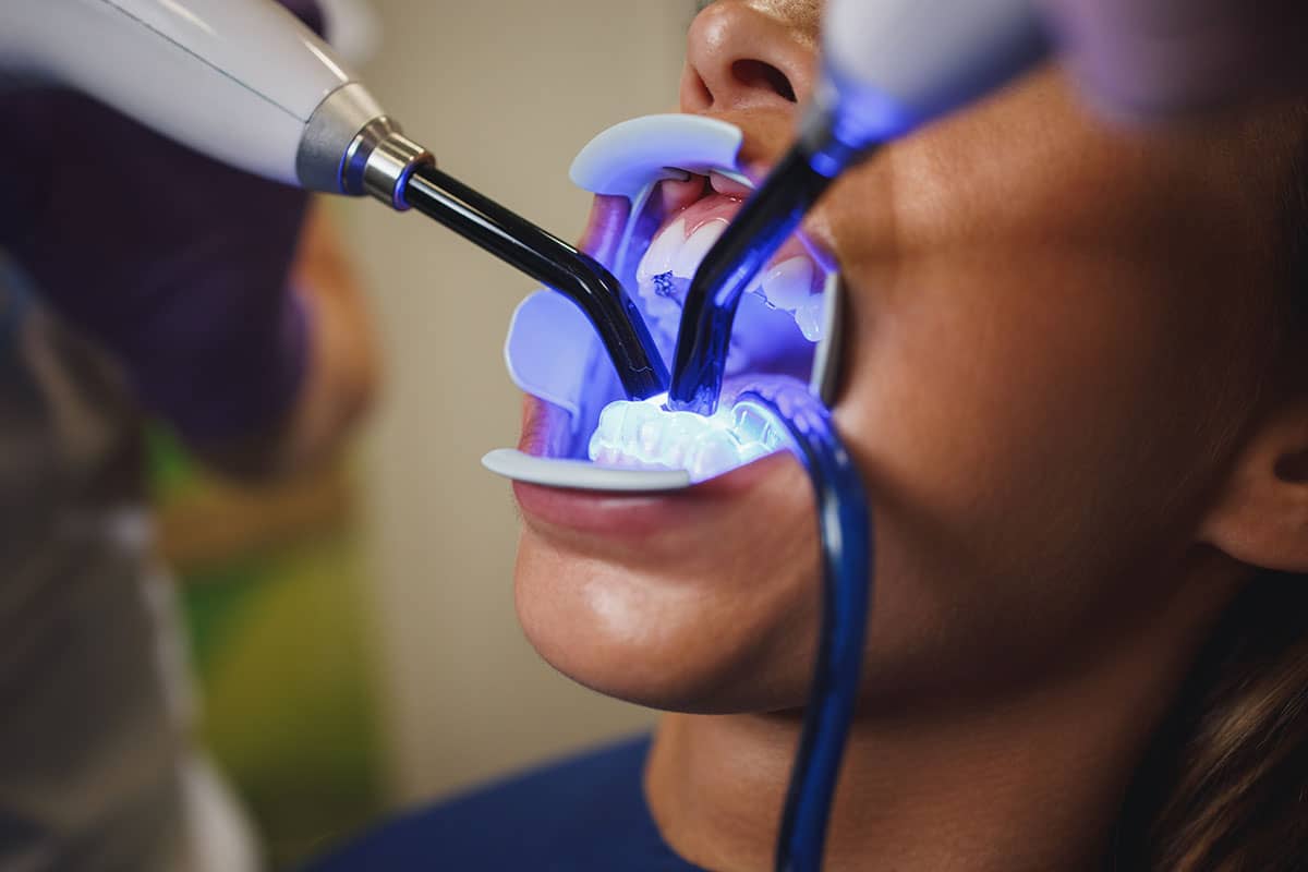 Soft tissue laser for gentle gum treatment