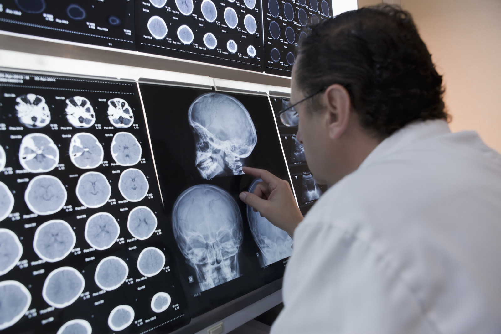 CBCT 3D imaging at Island Dental — precision diagnostics