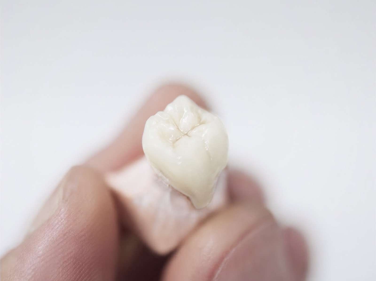 Ceramic dental crown held with forceps