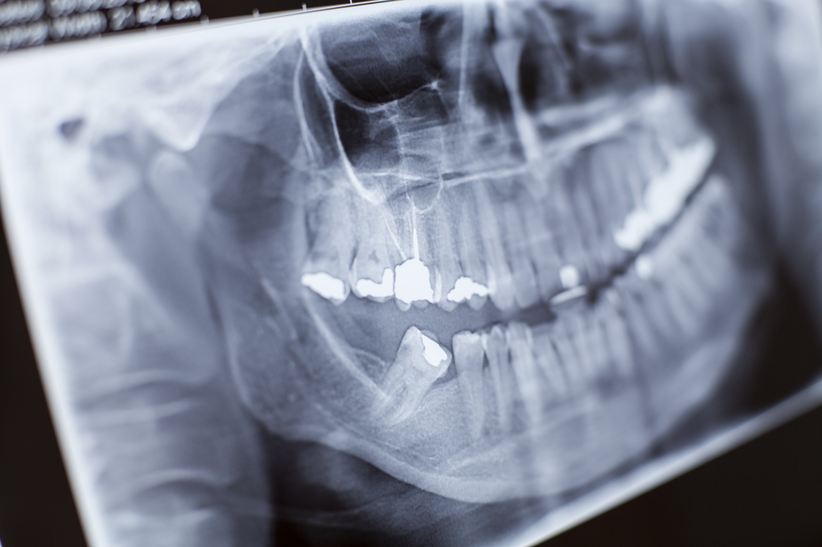 Pax-i3D digital X-ray and cone beam imaging unit at Island Dental
