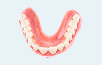 Horseshoe Upper Denture