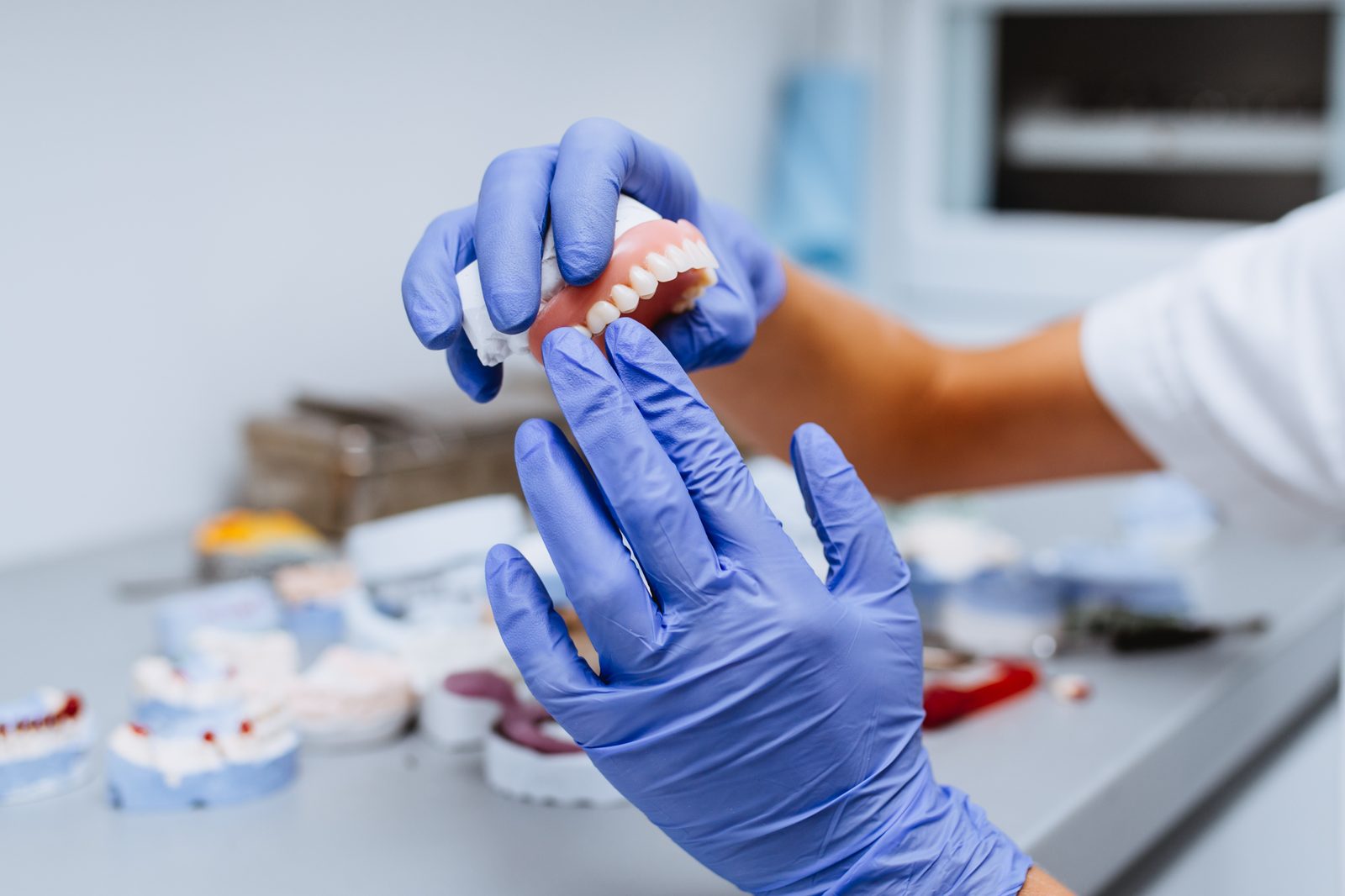 Custom full dentures crafted by Island Dental lab technicians