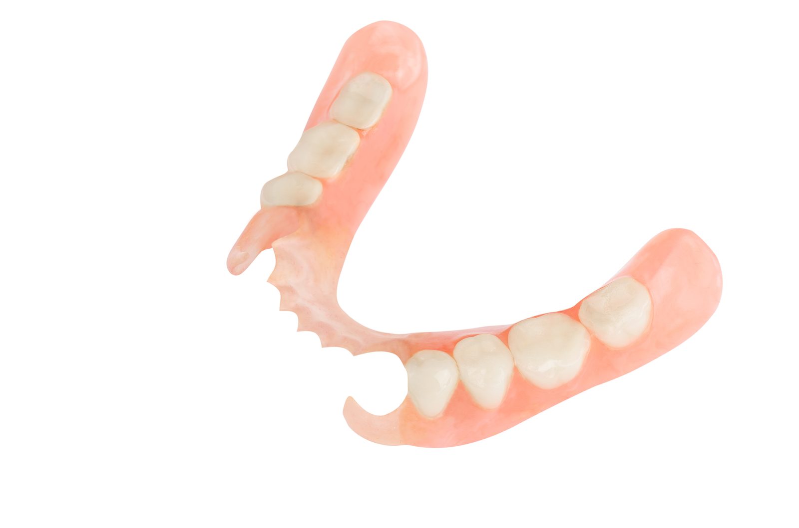 Flexible nylon partial denture — lightweight and metal-free