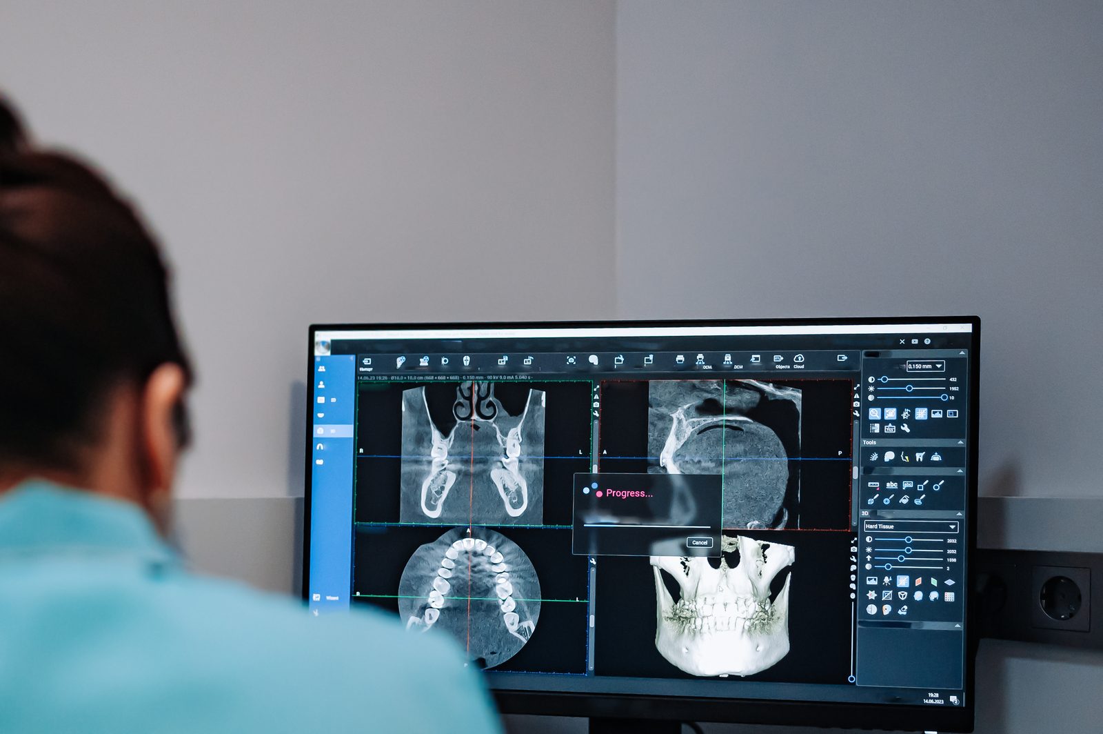 Reviewing a 3D CT scan for computer-guided implant planning